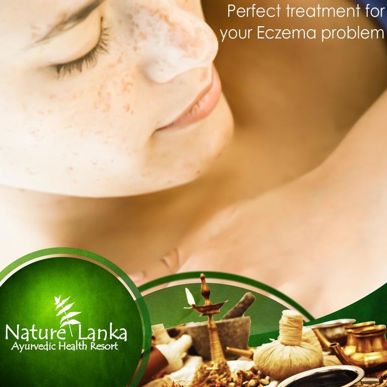 Nature Lanka Ayurveda Resort - All Meals And Ayurveda Treatments With Yoga Tangalle Esterno foto